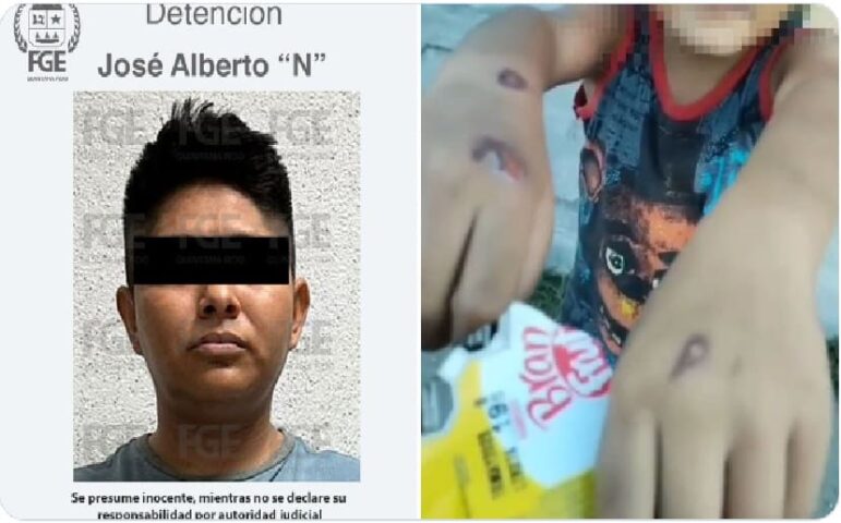 Police track down step father accused of burning 6 year old with lighter
