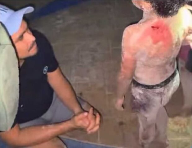 7 year old mauled by loose dog on Playa del Carmen beach
