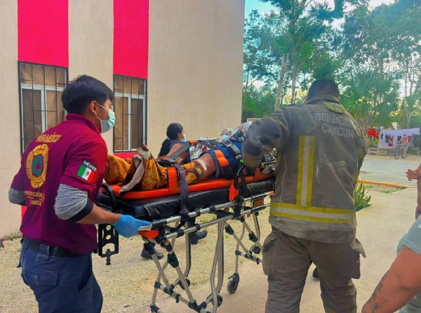 Resident suffers third degree burns from flash LP gas explosion